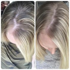 Monat Before and After Picture